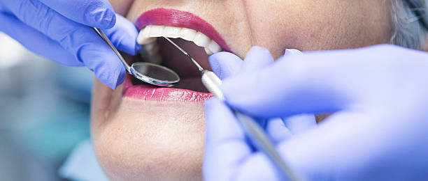Best Emergency Root Canal Treatment in Youngstown, OH
